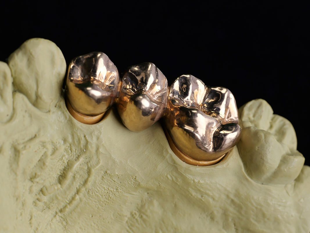 Audental A75 (HIGH NOBL /Crown&Bridge alloy /Yellow/Au75%)